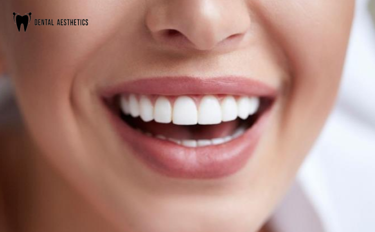 Dental Implants in May 2025