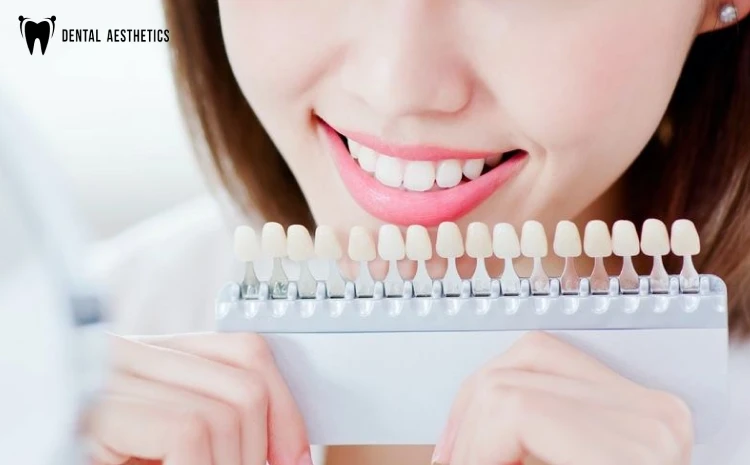 Smile Makeover and Cosmetic Dentistry | Dental Aesthetics