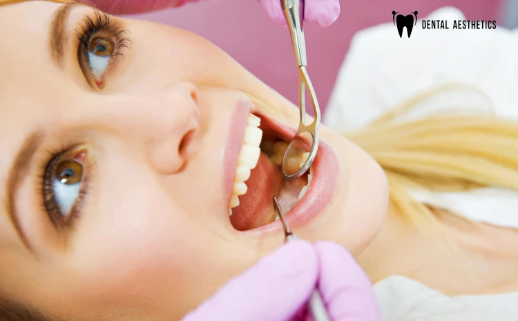 ROOT CANAL TREATMENT - PREVENTION, TREATMENT AND CARE