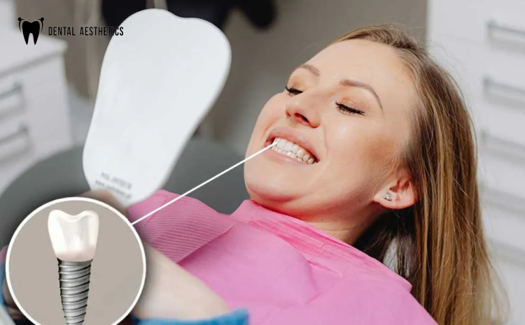 Real Results from Dental Implants in Lahore