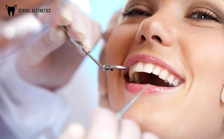 Replacing Missing Teeth: Best Solutions at Dental Aesthetics