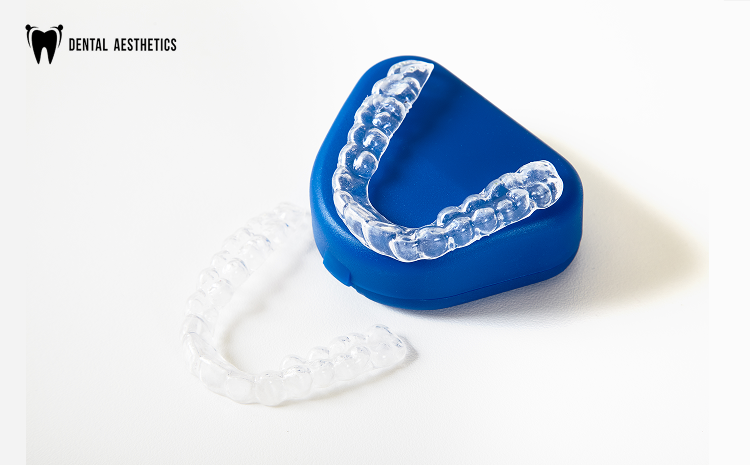 Getting Aligners in Lahore