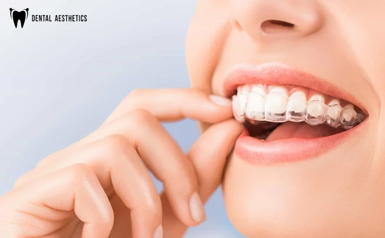 Discreet & Effective Teeth Alignment with Clear Path Aligners