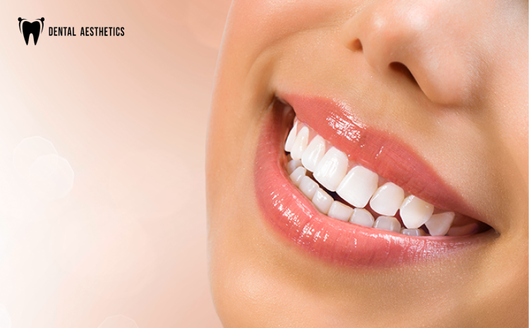 choosing-laser-teeth-whitening