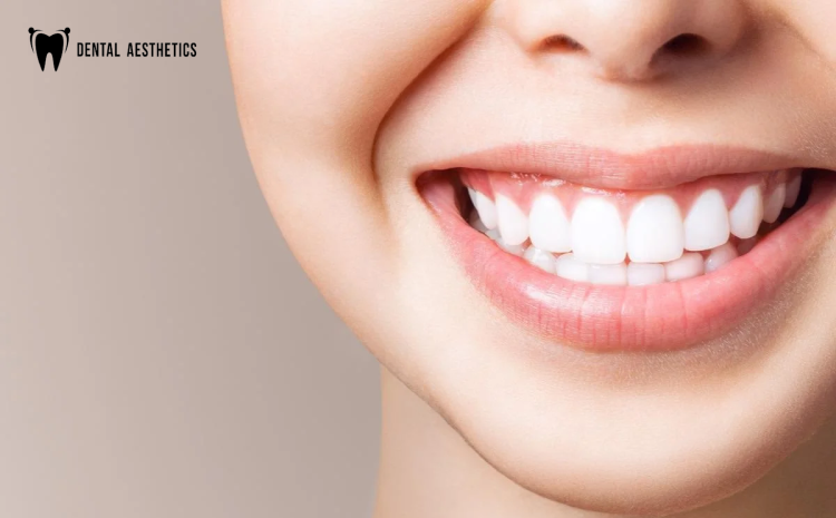 Teeth Whitening in Lahore
