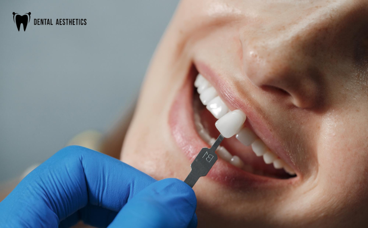 dental-implants-in-2025