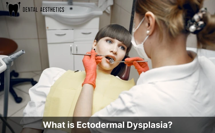 what is ectodermaldysplasia