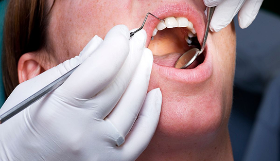 Dental restoration